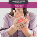 Arthritis Replay
