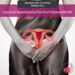 Cervical Spondylosis/Cervical Osteoarthritis