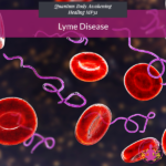 Lyme Disease