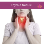 Thyroid Nodule
