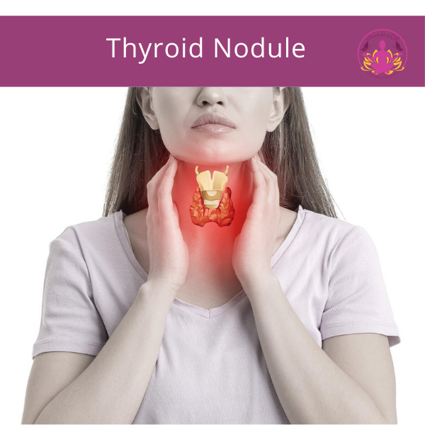 Thyroid Nodule 1