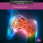 Osteoporosis Mp3